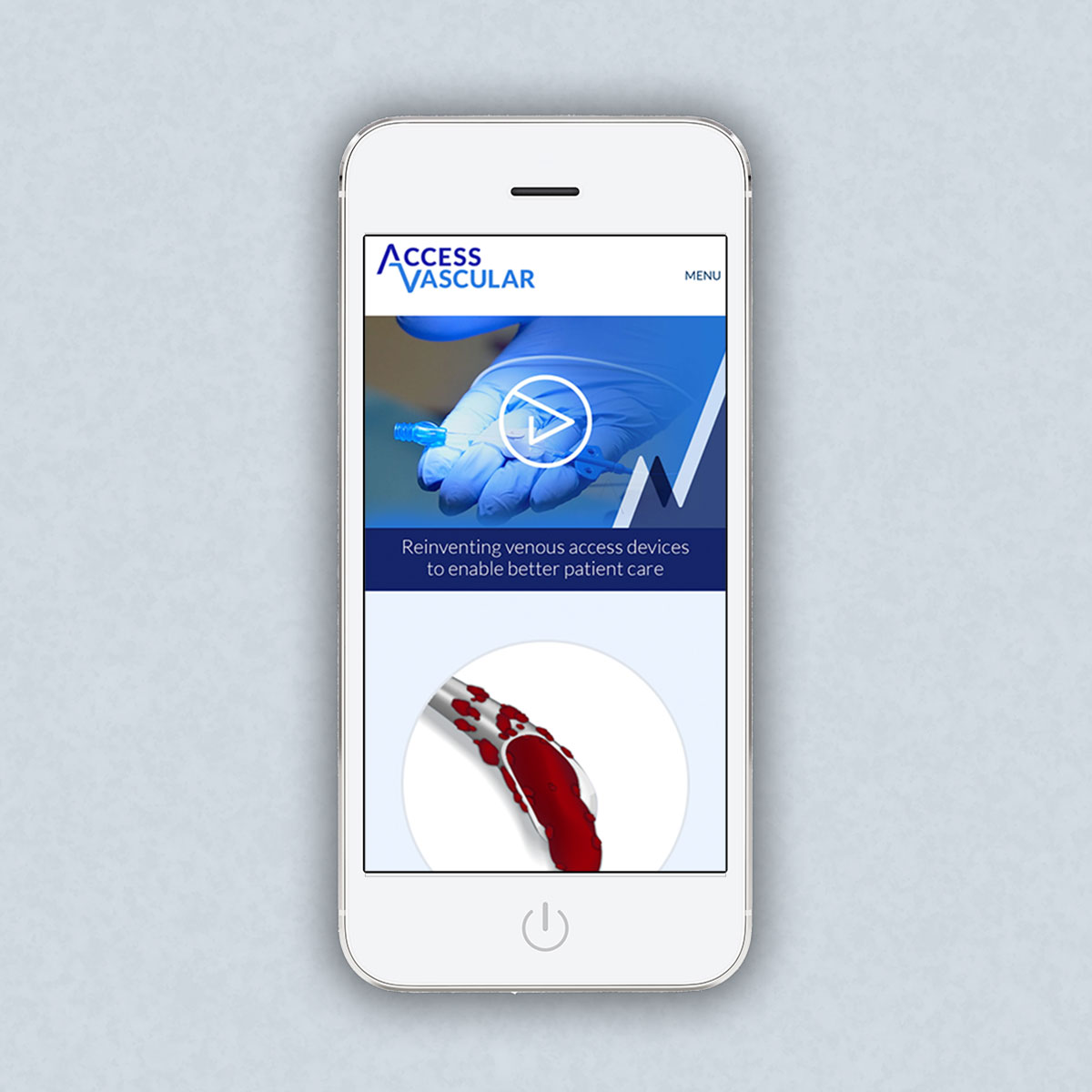 Access Vascular Website Design – Homepage on a Mobile Phone